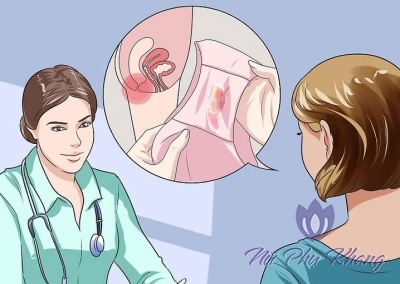 Bắt bệnh phụ khoa nhờ khí hư