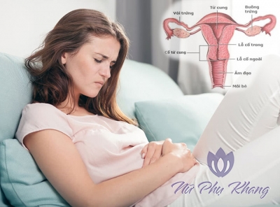 Đau bụng dưới nguy cơ tiềm ẩn viêm phần phụ và nhiều căn bệnh