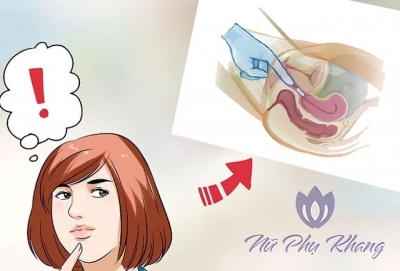 Cách đặt thuốc chữa viêm lộ tuyến cổ tử cung