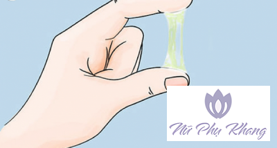 Khí hư có mùi chua – biểu hiện của viêm nhiễm phụ khoa