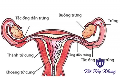 Chị em tắc vòi trứng có kinh nguyệt không?