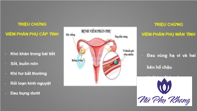 Viêm phần phụ hai bên và những điều chị em cần lưu ý