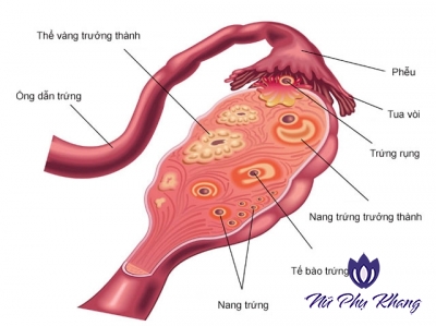 Rối loạn kinh nguyệt vì suy buồng trứng sớm đe dọa sức khỏe sinh sản của nữ giới