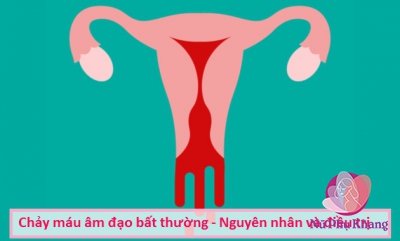 Chảy máu âm đạo bất thường cần phải làm gì?