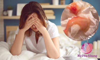 Khí hư lẫn máu giữa chu kì: Nguyên nhân là do đâu?