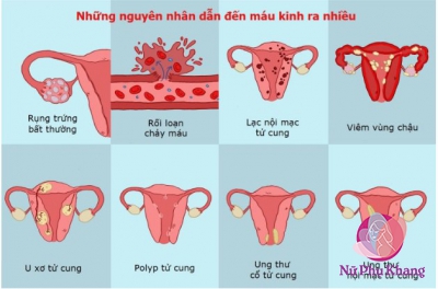 Nhận biết 5 dấu hiệu kinh nguyệt bất thường ở tuổi dậy thì
