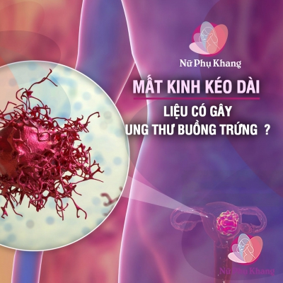 Mất kinh kéo dài liệu có gây ung thư buồng trứng ?