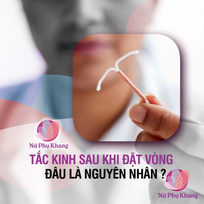 Tắc kinh sau khi đặt vòng, đâu là nguyên nhân ?