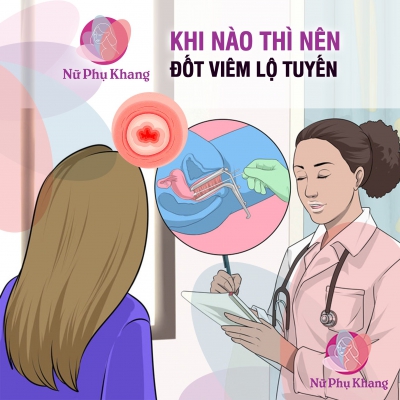 Khi nào thì nên đốt viêm lộ tuyến