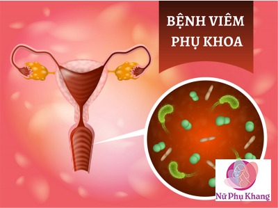 Vì sao chị em hay bị viêm phụ khoa dai dẳng