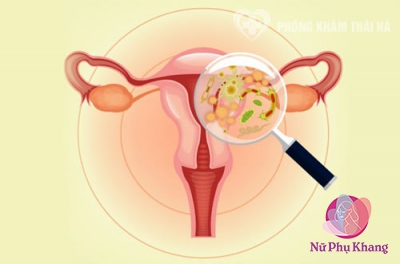  Vì sao đã giữ vệ sinh sạch sẽ nhưng vẫn bị viêm nhiễm phụ khoa 