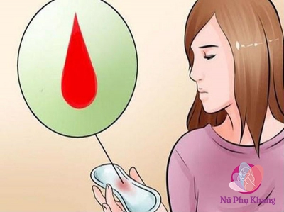 35 tuổi đã bị tắc kinh nhiều tháng, liệu tôi có bị mãn kinh sớm không?